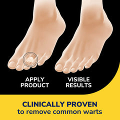 Clear Away® Wart Removers Seal & Heal Bandage with Hydrogel Technology