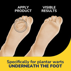 Plantar Wart Remover Seal & Heal Bandage with Hydrogel Technology