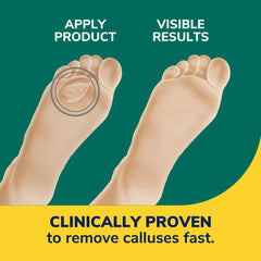 Callus Removers Seal & Heal Bandage with Hydrogel Technology